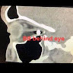 Meet your Posher, Dylan